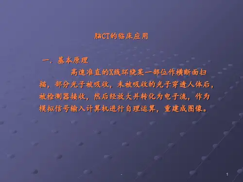 颅脑CTpptppt课件