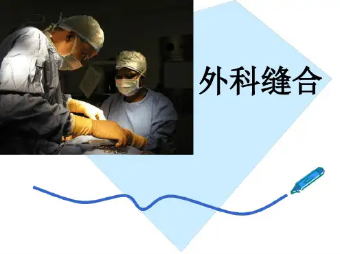 外科缝合常用方法ppt课件