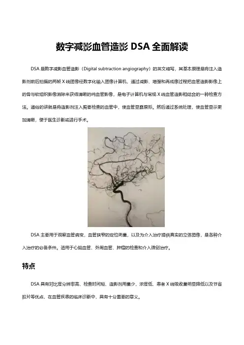(优质)数字减影血管造影DSA全面解读