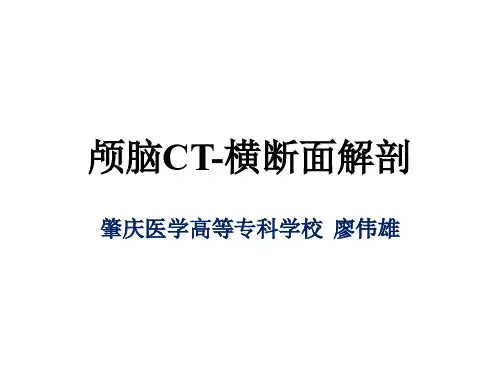 01颅脑CT断层
