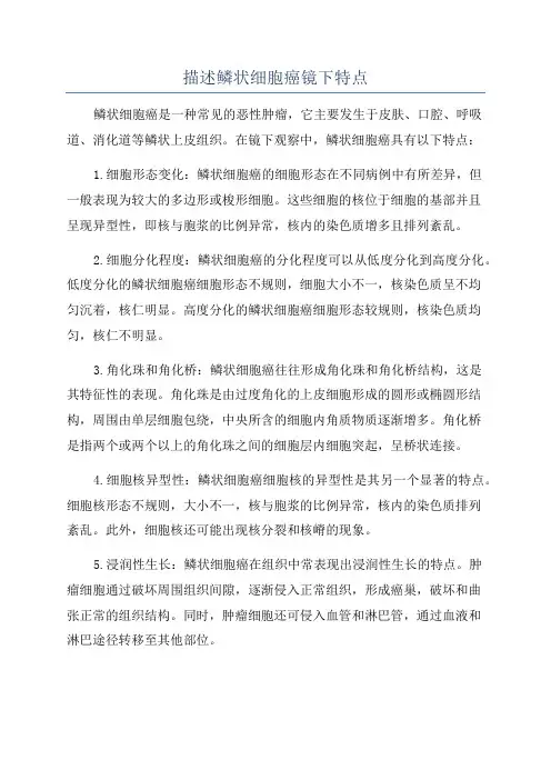 描述鳞状细胞癌镜下特点