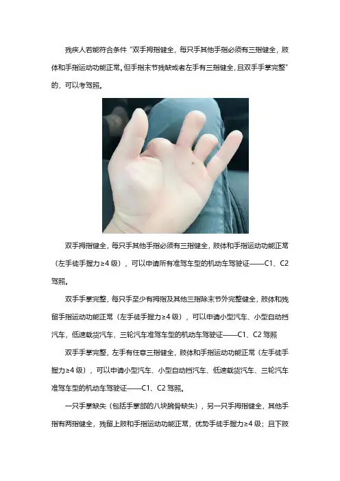 手有残疾可以考驾照吗