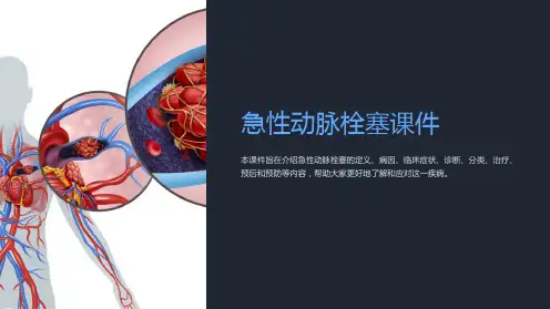 急性动脉栓塞课件