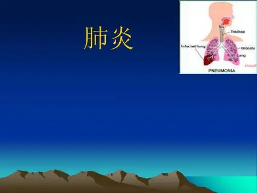 内科学肺炎
