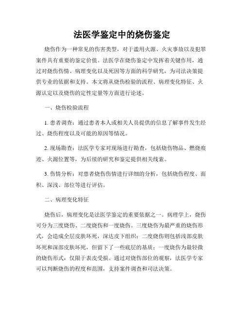 法医学鉴定中的烧伤鉴定