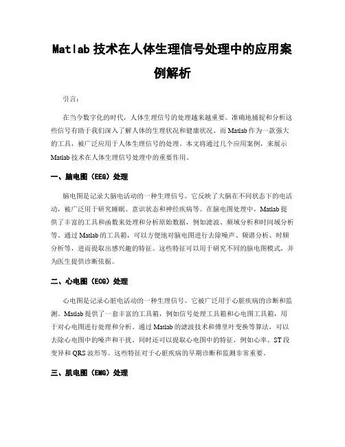 Matlab技术在人体生理信号处理中的应用案例解析
