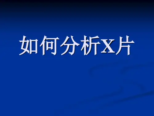 如何分析x片
