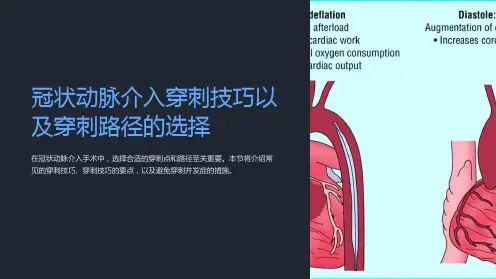 冠状动脉介入穿刺技巧以及穿刺路径的选择