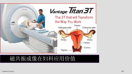 子宫MRI诊断专题知识