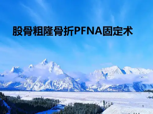 股骨粗隆骨折PFNA固定术PPT课件