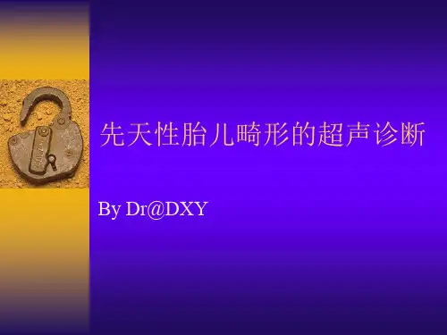 胎儿畸形超声ppt课件