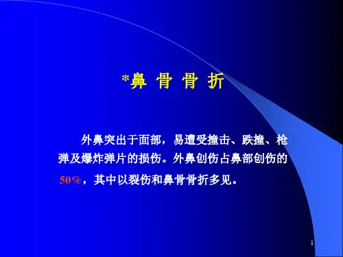 鼻骨骨折PPT课件