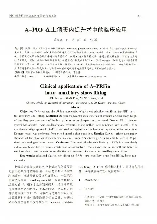 a-prf在上颌窦内提升术中的临床应用