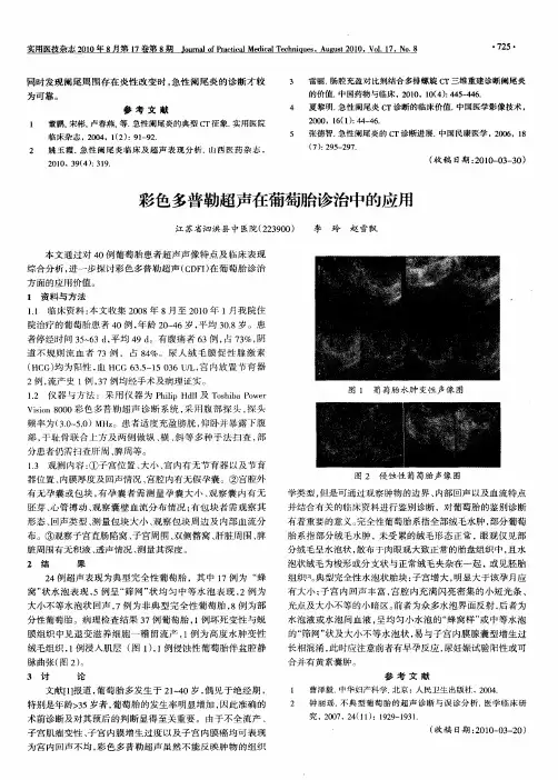 彩色多普勒超声在葡萄胎诊治中的应用
