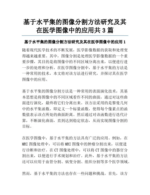 基于水平集的图像分割方法研究及其在医学图像中的应用共3篇