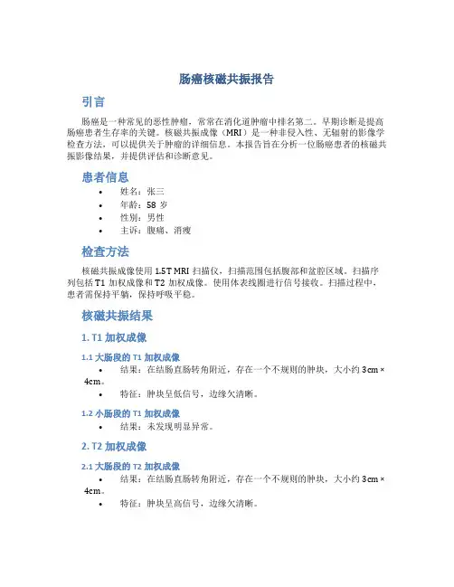 肠癌核磁共振报告