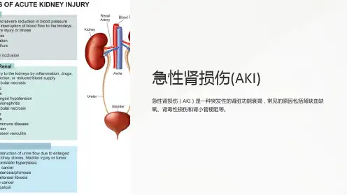 急性肾损伤(AKI)