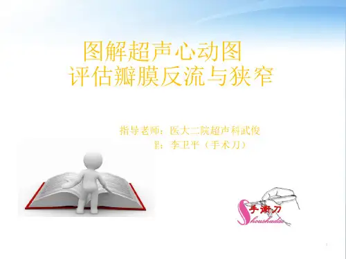 图解超声心动图评估瓣膜反流程度
