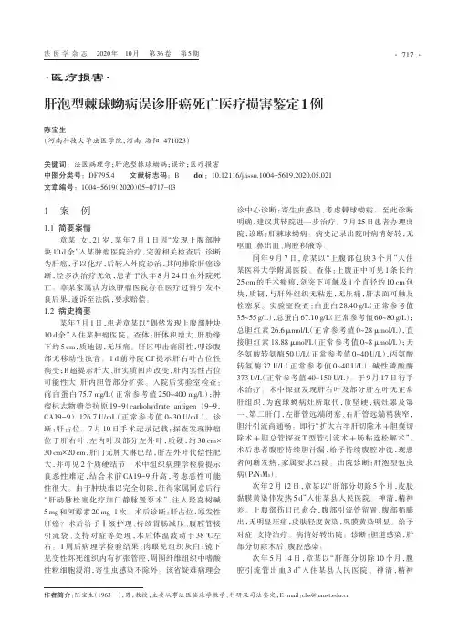 肝泡型棘球蚴病误诊肝癌死亡医疗损害鉴定1例
