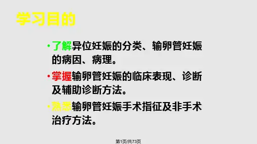 异位妊娠课件PPT课件