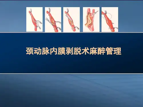 颈动脉内膜剥脱术麻醉管理PPT课件