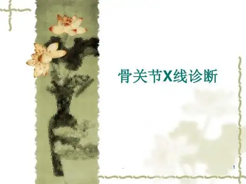 骨关节PPT课件