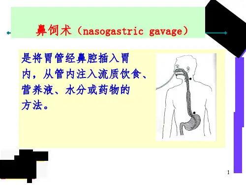 鼻饲术PPT精品文档