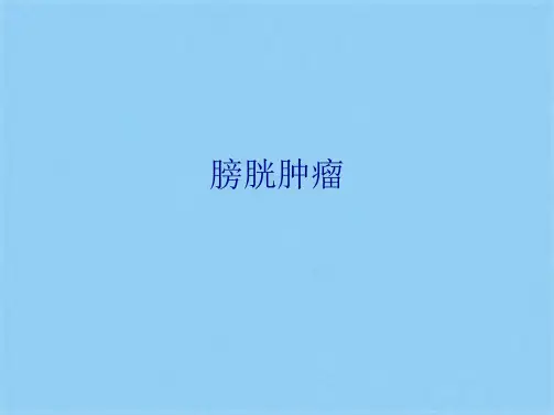 膀胱肿瘤(共12张PPT)