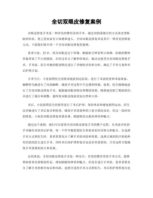 全切双眼皮修复案例