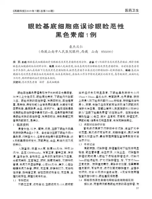 眼睑基底细胞癌误诊眼睑恶性黑色素瘤1例