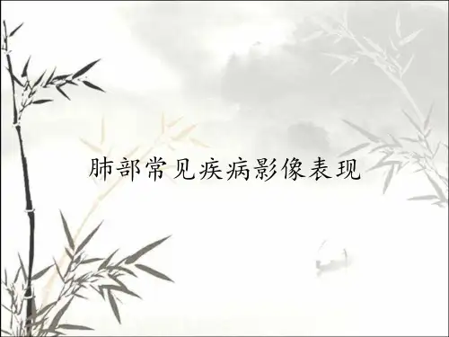 肺部常见疾病影像表现