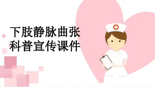 下肢静脉曲张科普宣传课件