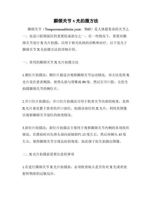 颞颌关节x光拍摄方法