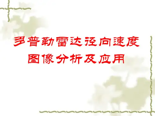 航空气象学：10.1_2 雷达径向速度图