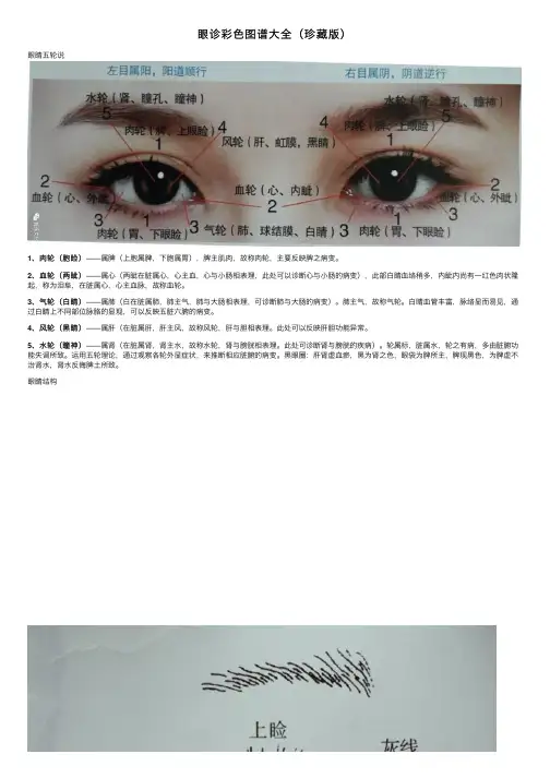 眼诊彩色图谱大全（珍藏版）