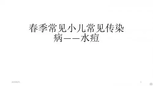 春季常见小儿常见传染病PPT课件
