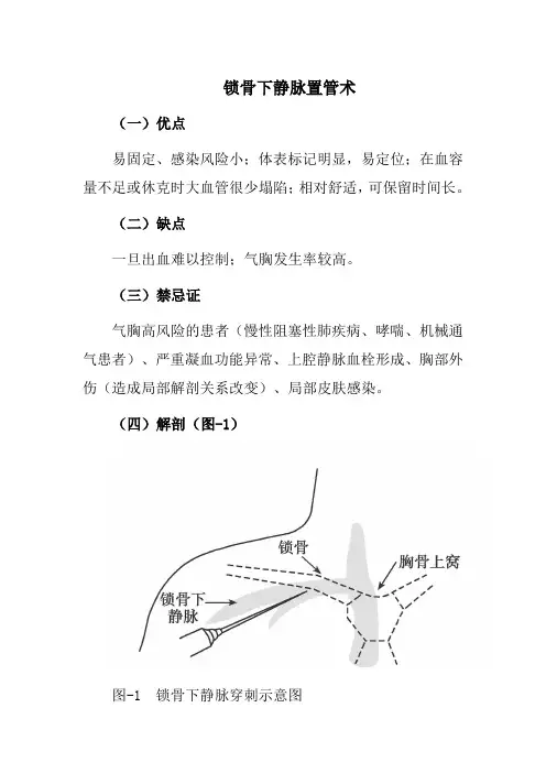 锁骨下静脉置管术