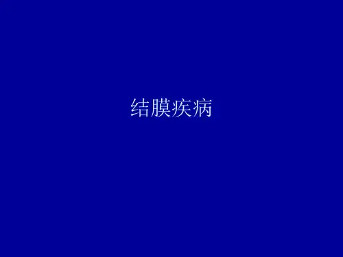 眼科学 第七章 结膜疾病