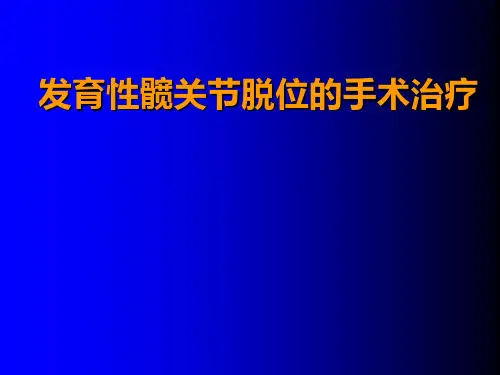 发育性髋关节脱位手术治疗