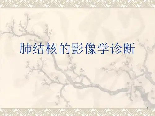 肺结核的影像学诊断PPT课件