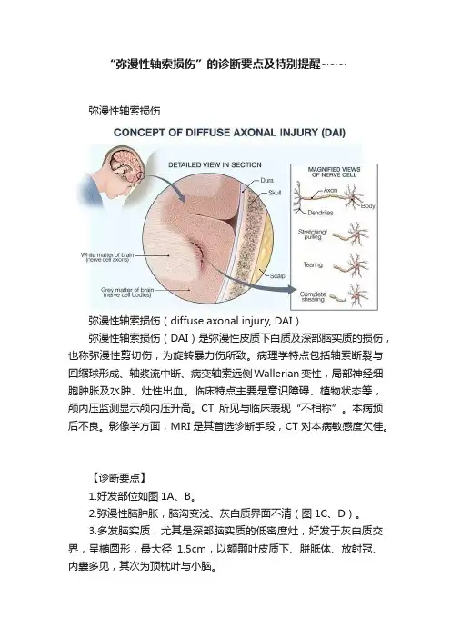 “弥漫性轴索损伤”的诊断要点及特别提醒~~~