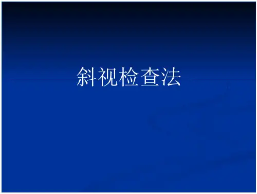 斜视检查法讲解