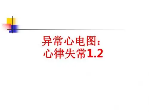 [课件]异常心电图：心律失常1.2PPT