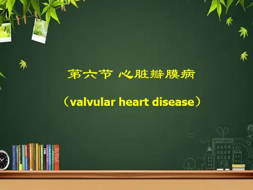 心脏瓣膜病-PPT课件