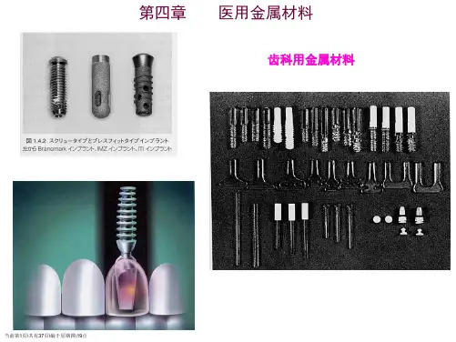 生物材料导论6医用金属4a