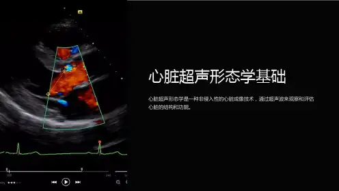 心脏超声形态学基础