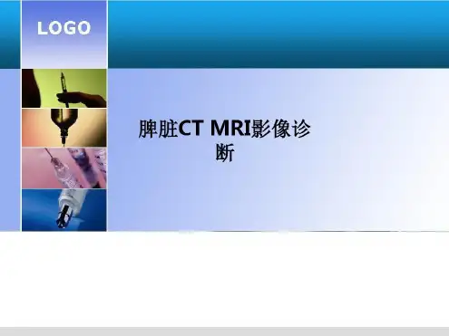脾脏CTMRI影像诊断