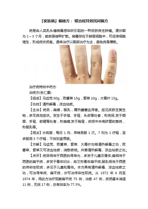 『皮肤病』偏秘方：?根治疣特效民间偏方
