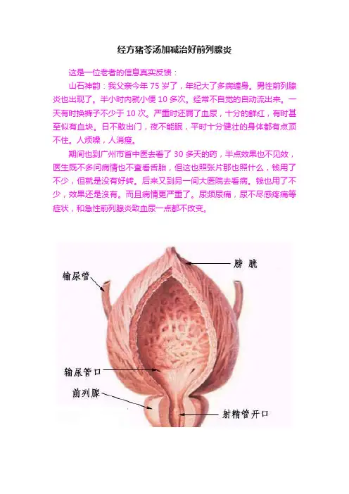 经方猪苓汤加减治好前列腺炎