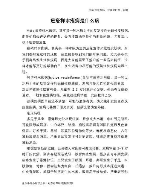 痘疮样水疱病是什么病